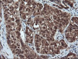 PSMA6 Antibody in Immunohistochemistry (Paraffin) (IHC (P))