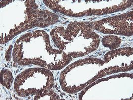 PSMA6 Antibody in Immunohistochemistry (Paraffin) (IHC (P))