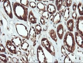 PSMA6 Antibody in Immunohistochemistry (Paraffin) (IHC (P))