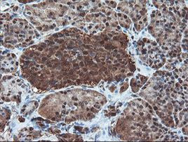 PSMA6 Antibody in Immunohistochemistry (Paraffin) (IHC (P))