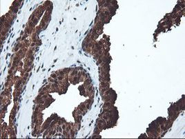 PSMA6 Antibody in Immunohistochemistry (Paraffin) (IHC (P))