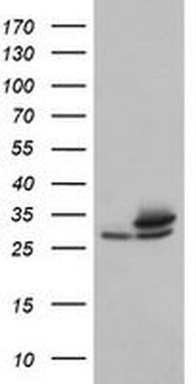 PSMA6 Antibody in Western Blot (WB)