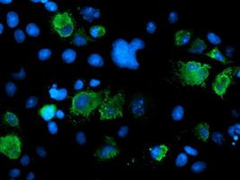 SENP2 Antibody in Immunocytochemistry (ICC/IF)