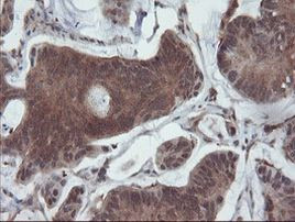 SENP2 Antibody in Immunohistochemistry (Paraffin) (IHC (P))