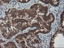 SENP2 Antibody in Immunohistochemistry (Paraffin) (IHC (P))