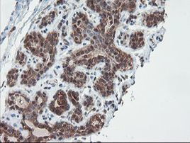 SENP2 Antibody in Immunohistochemistry (Paraffin) (IHC (P))