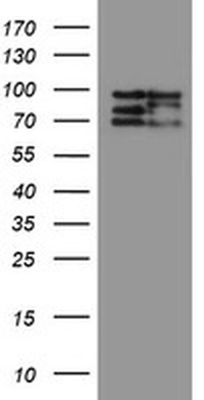 CNOT4 Antibody in Western Blot (WB)