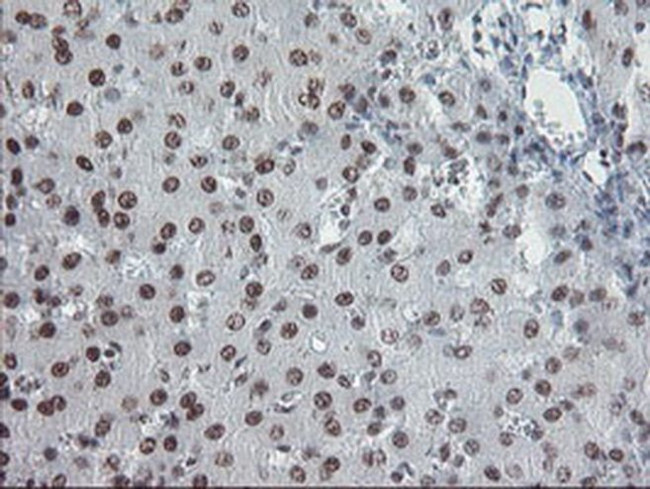 TPRKB Antibody in Immunohistochemistry (Paraffin) (IHC (P))