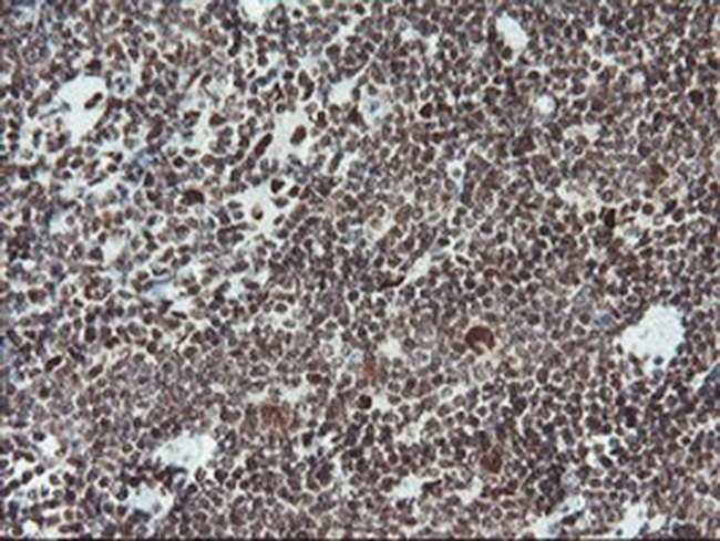 TPRKB Antibody in Immunohistochemistry (Paraffin) (IHC (P))