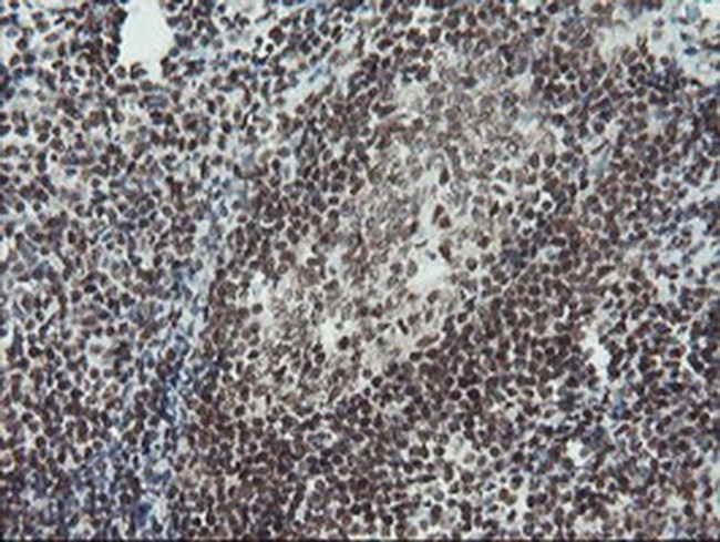 TPRKB Antibody in Immunohistochemistry (Paraffin) (IHC (P))