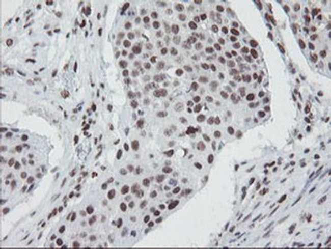 TPRKB Antibody in Immunohistochemistry (Paraffin) (IHC (P))