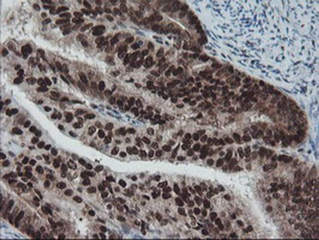 TPRKB Antibody in Immunohistochemistry (Paraffin) (IHC (P))