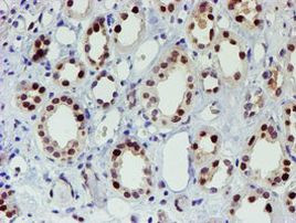 SLUG Antibody in Immunohistochemistry (Paraffin) (IHC (P))