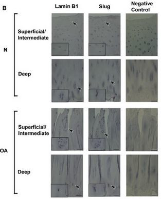 SLUG Antibody in Immunohistochemistry (Paraffin) (IHC (P))