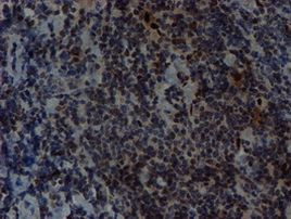 SLUG Antibody in Immunohistochemistry (Paraffin) (IHC (P))