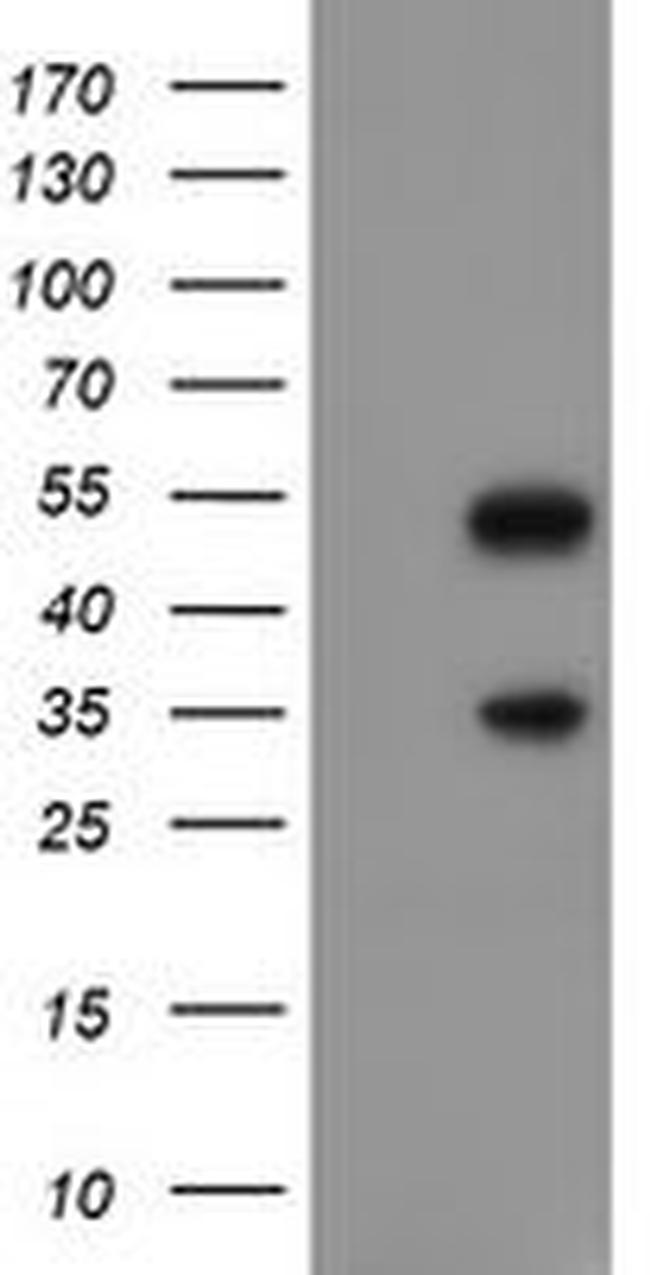 SLUG Antibody in Western Blot (WB)