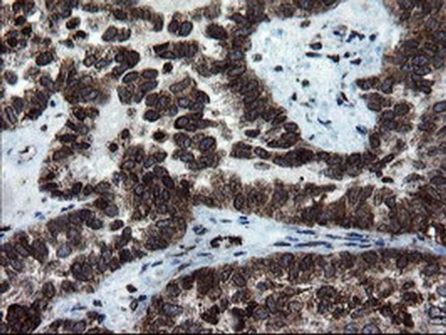 SnoN Antibody in Immunohistochemistry (Paraffin) (IHC (P))