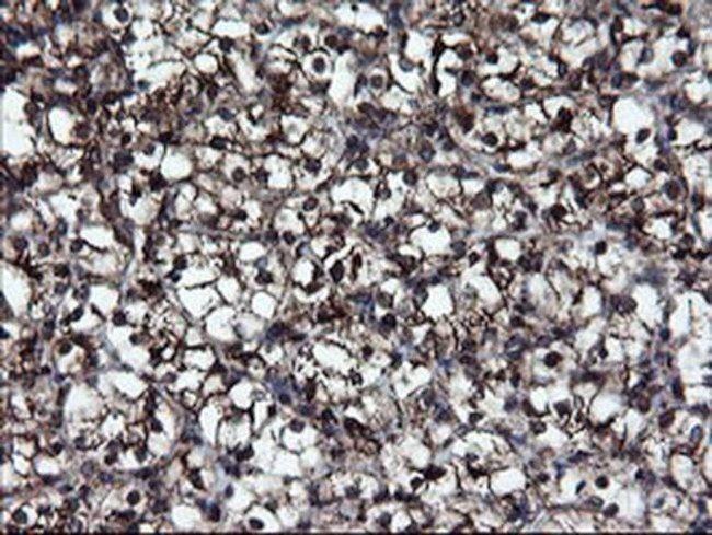 SnoN Antibody in Immunohistochemistry (Paraffin) (IHC (P))