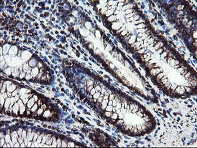 SnoN Antibody in Immunohistochemistry (Paraffin) (IHC (P))