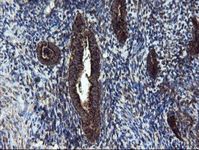 SnoN Antibody in Immunohistochemistry (Paraffin) (IHC (P))