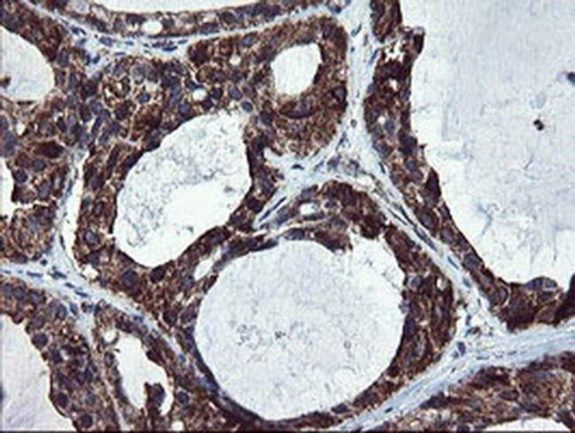 SnoN Antibody in Immunohistochemistry (Paraffin) (IHC (P))