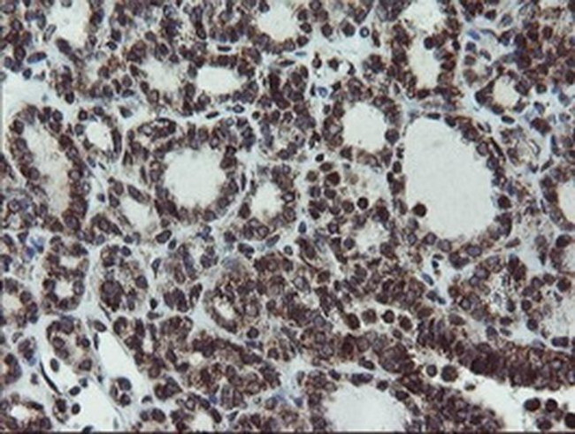 SnoN Antibody in Immunohistochemistry (Paraffin) (IHC (P))