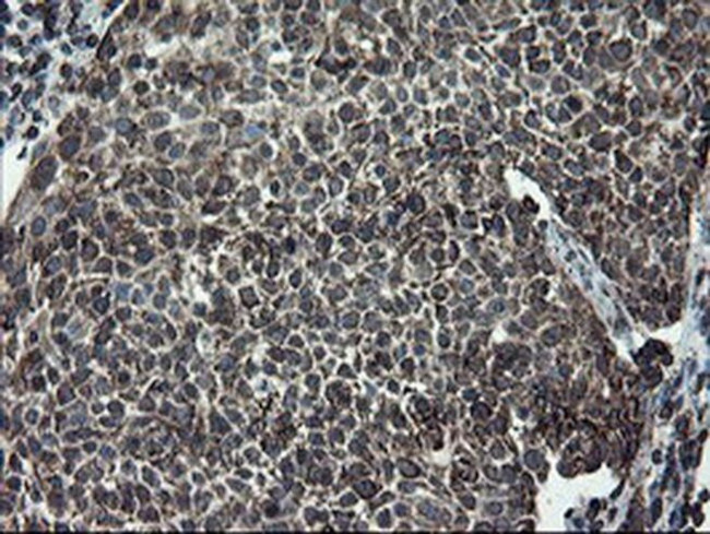 SnoN Antibody in Immunohistochemistry (Paraffin) (IHC (P))