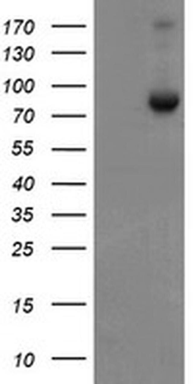 SnoN Antibody in Western Blot (WB)