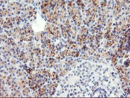 SLUG Antibody in Immunohistochemistry (Paraffin) (IHC (P))