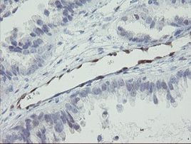 RBPMS Antibody in Immunohistochemistry (Paraffin) (IHC (P))