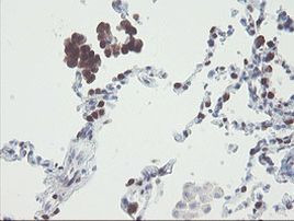 RBPMS Antibody in Immunohistochemistry (Paraffin) (IHC (P))