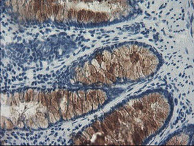 FBXO42 Antibody in Immunohistochemistry (Paraffin) (IHC (P))