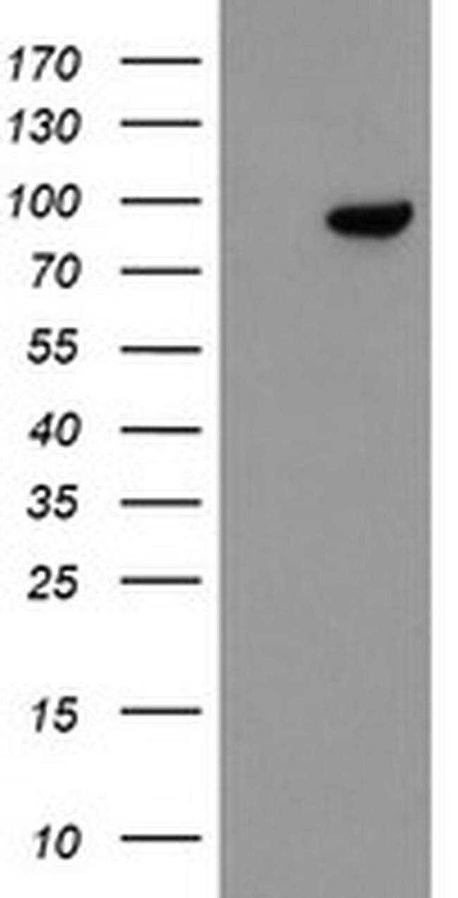 FBXO42 Antibody in Western Blot (WB)