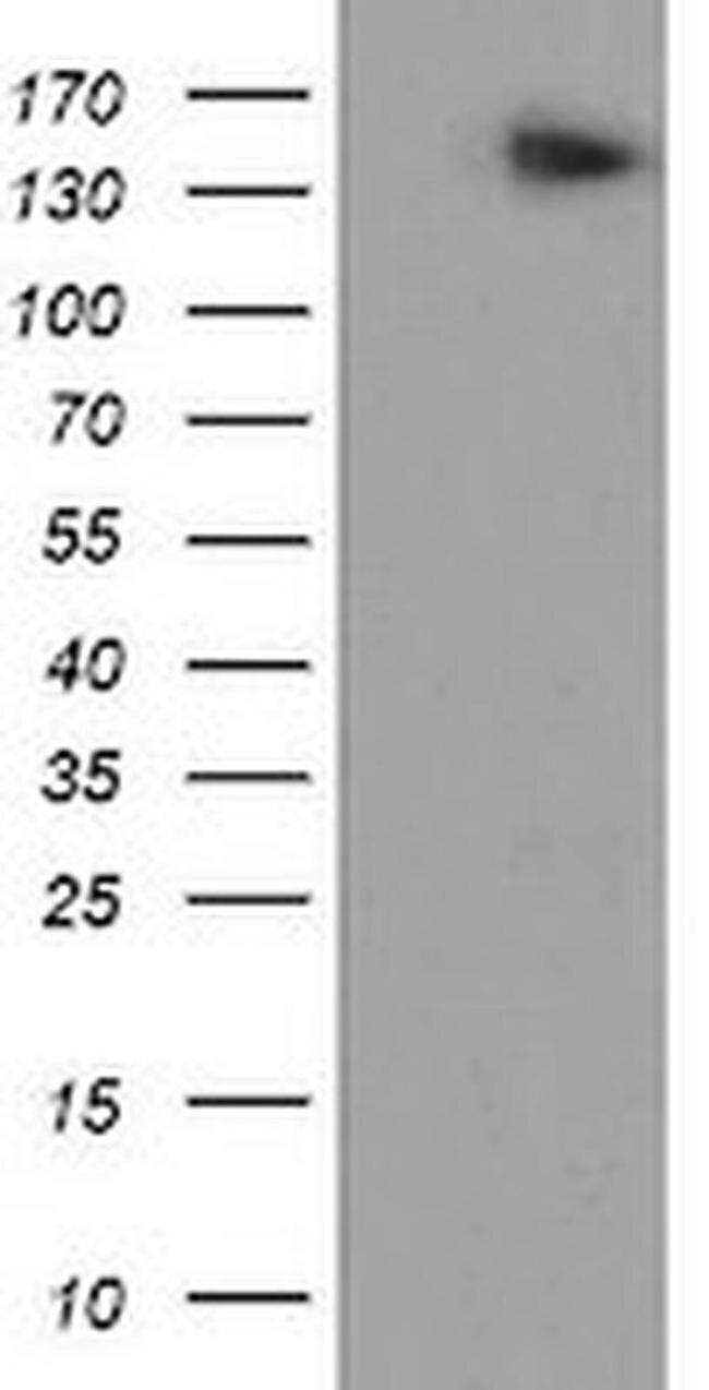 AGTPBP1 Antibody in Western Blot (WB)