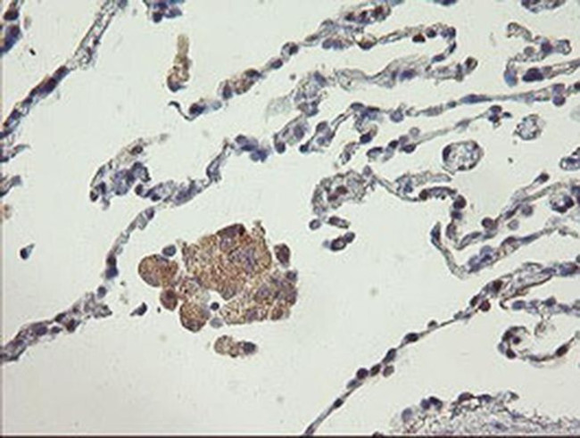 AGTPBP1 Antibody in Immunohistochemistry (Paraffin) (IHC (P))