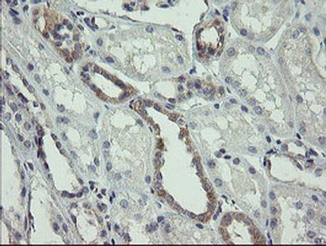 AGTPBP1 Antibody in Immunohistochemistry (Paraffin) (IHC (P))