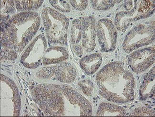 AGTPBP1 Antibody in Immunohistochemistry (Paraffin) (IHC (P))