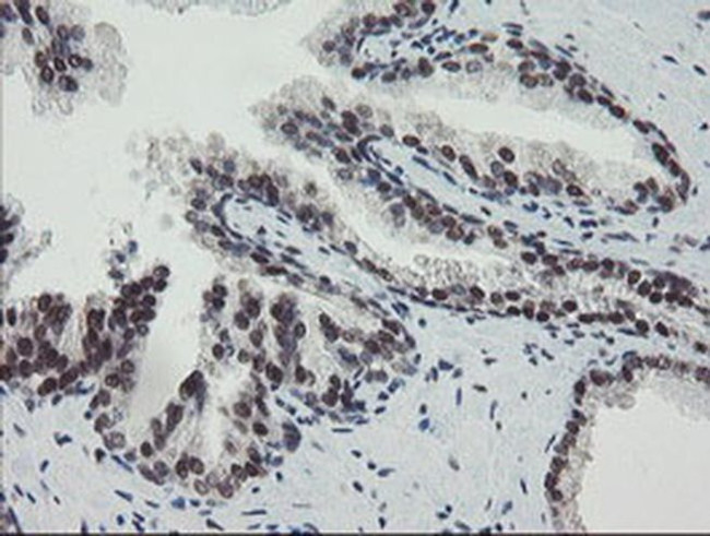 TPRKB Antibody in Immunohistochemistry (Paraffin) (IHC (P))