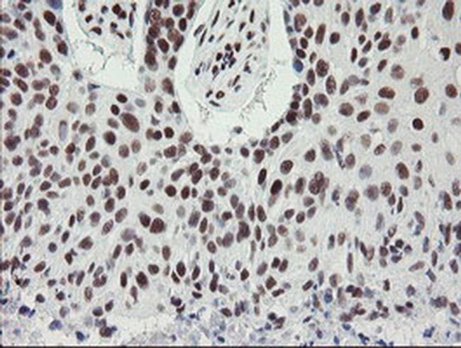 TPRKB Antibody in Immunohistochemistry (Paraffin) (IHC (P))