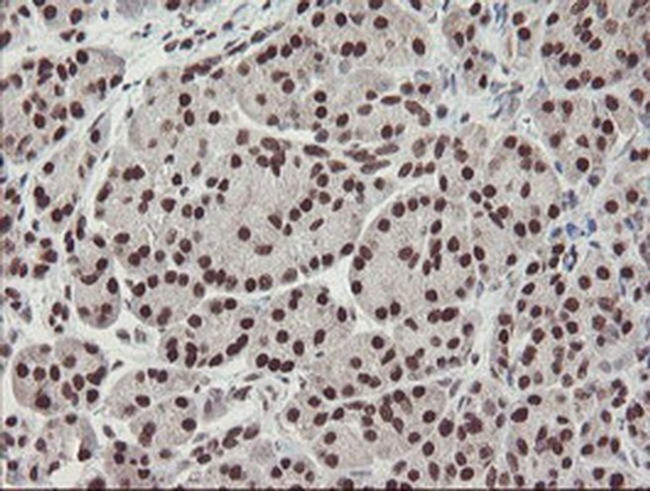 TPRKB Antibody in Immunohistochemistry (Paraffin) (IHC (P))