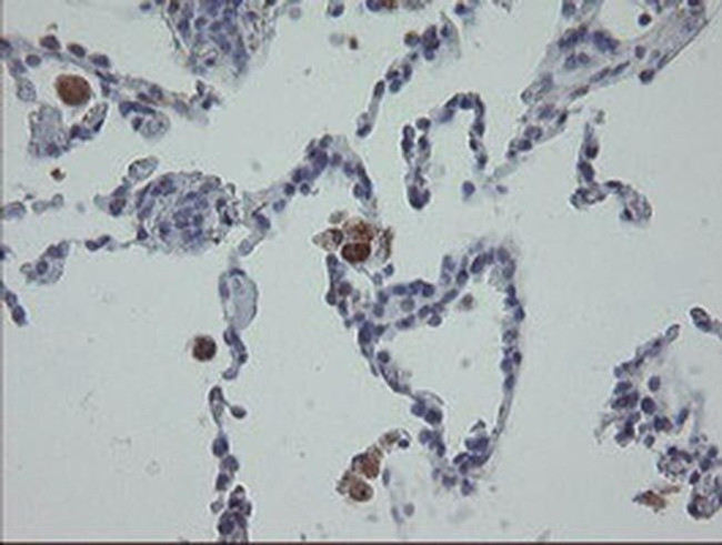 MRPS27 Antibody in Immunohistochemistry (Paraffin) (IHC (P))