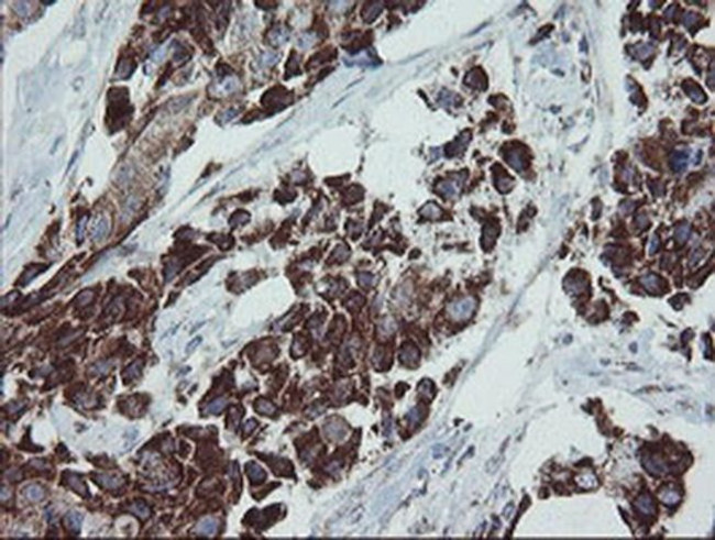 MRPS27 Antibody in Immunohistochemistry (Paraffin) (IHC (P))