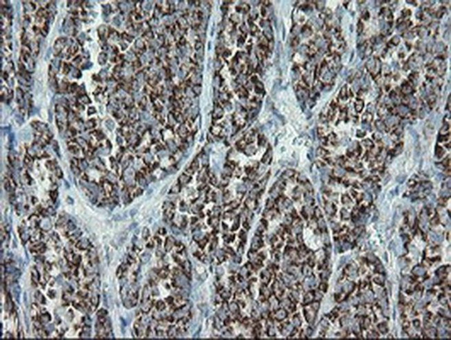 MRPS27 Antibody in Immunohistochemistry (Paraffin) (IHC (P))