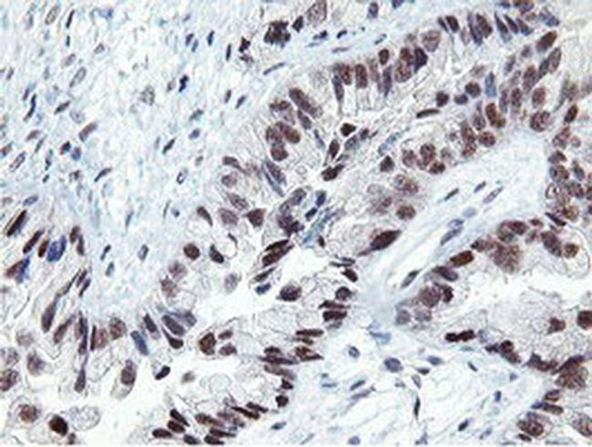 LANCL2 Antibody in Immunohistochemistry (Paraffin) (IHC (P))