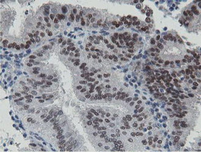 LANCL2 Antibody in Immunohistochemistry (Paraffin) (IHC (P))