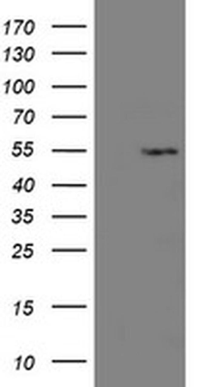 LANCL2 Antibody in Western Blot (WB)