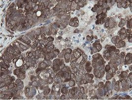 MIPEP Antibody in Immunohistochemistry (Paraffin) (IHC (P))