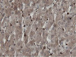 MIPEP Antibody in Immunohistochemistry (Paraffin) (IHC (P))