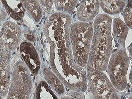 MIPEP Antibody in Immunohistochemistry (Paraffin) (IHC (P))