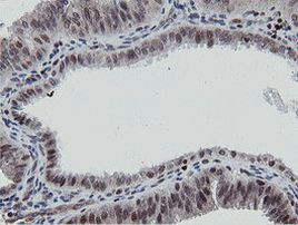 MIPEP Antibody in Immunohistochemistry (Paraffin) (IHC (P))